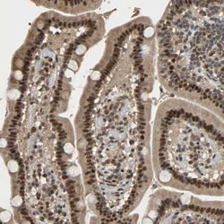 Cyclin T2 Antibody, Novus Biologicals:Antibodies:Primary Antibodies